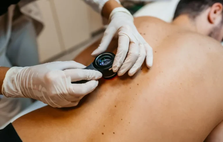 Skin Cancer Screening Why Regular Checks Can Save Your Life