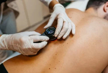skin cancer screening