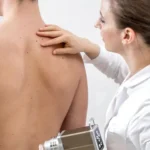 What Is Cryotherapy