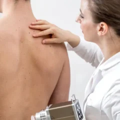 What Is Cryotherapy for Skin Lesions? Procedure, Uses and Aftercare